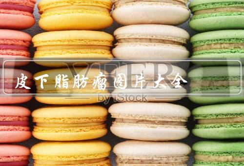 皮下脂肪瘤图片大全