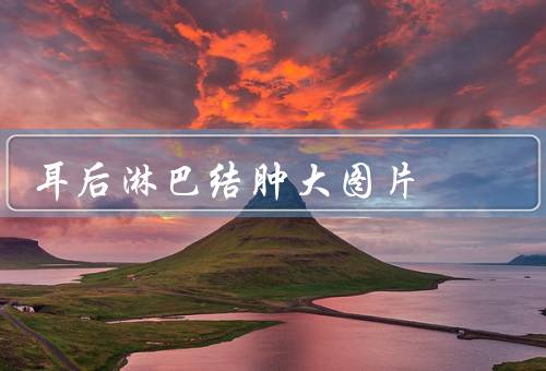 耳后淋巴结肿大图片