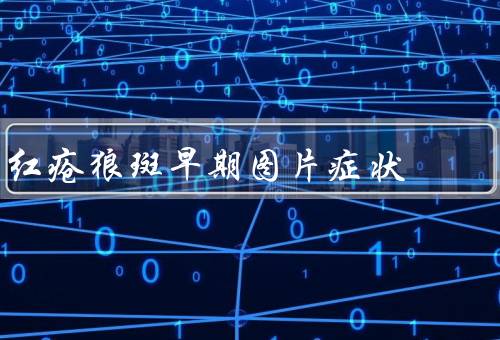 红疮狼斑早期图片症状
