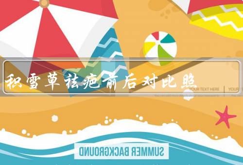 积雪草祛疤前后对比照