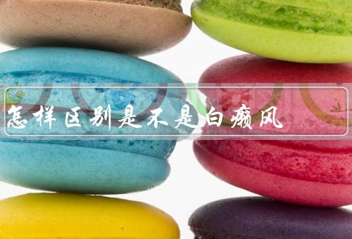 怎样区别是不是白癞风