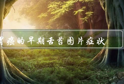 胃癌的早期舌苔图片症状