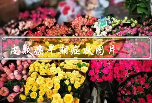 皮肤癌早期症状图片