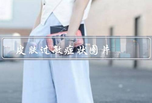 皮肤过敏症状图片