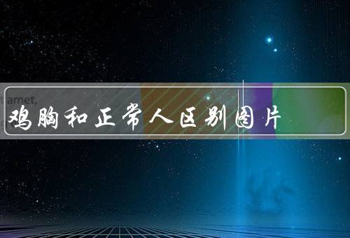 鸡胸和正常人区别图片