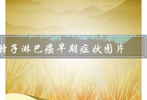 脖子淋巴癌早期症状图片，警惕触感饱满／无痛感肿块（共4个症状）