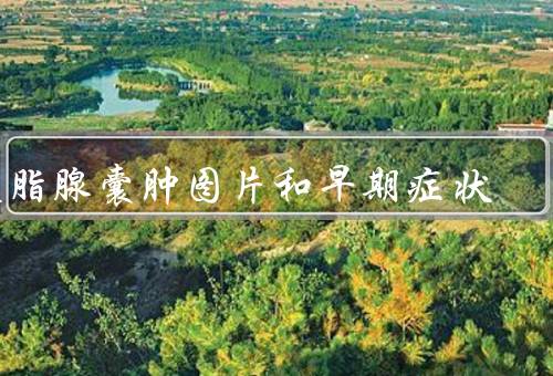 皮脂腺囊肿图片和早期症状