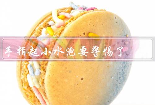 手指起小水泡要警惕了