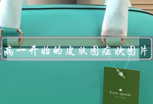 艾滋病一开始的皮肤图症状图片