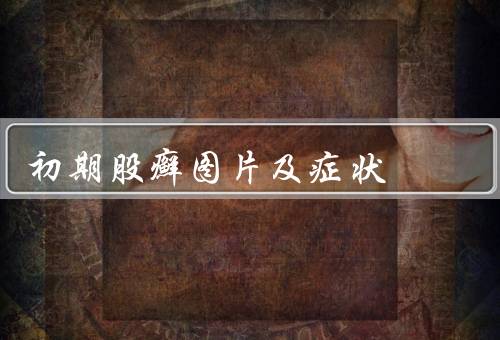 初期股癣图片及症状