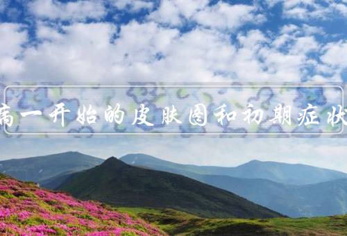 艾滋病一开始的皮肤图和初期症状