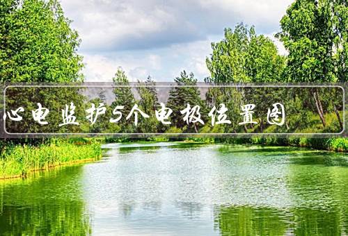 心电监护5个电极位置图