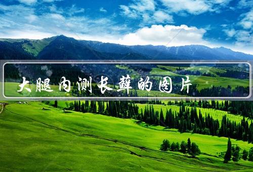 大腿内测长藓的图片