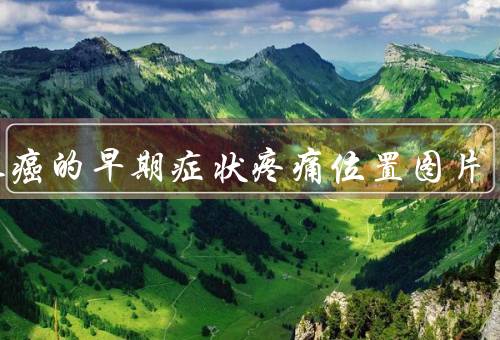 胰腺癌的早期症状疼痛位置图片