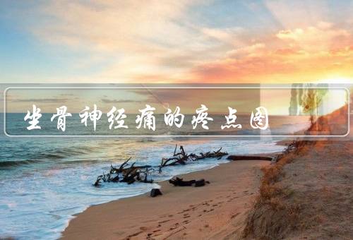 坐骨神经痛的疼点图