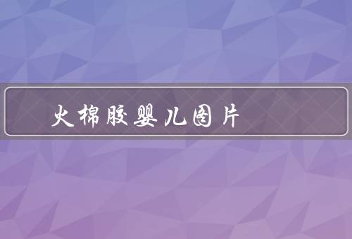 火棉胶婴儿图片