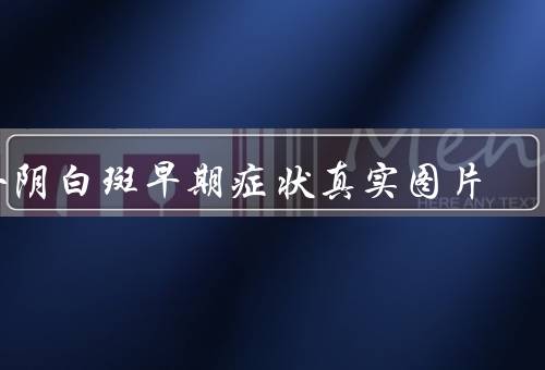 外阴白斑早期症状真实图片