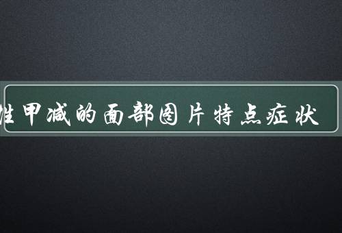 女性甲减的面部图片特点症状
