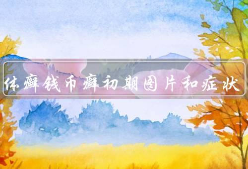 圆癣体癣钱币癣初期图片和症状