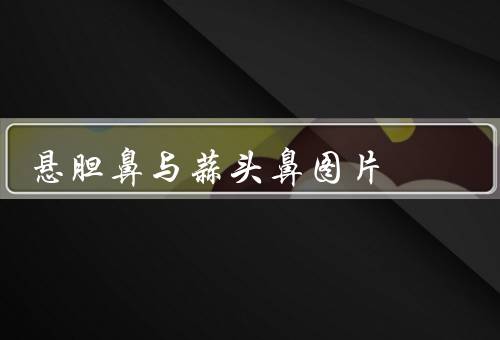 悬胆鼻与蒜头鼻图片，美观度不够但面相上非富即贵