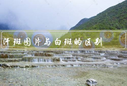 汗斑图片与白斑的区别